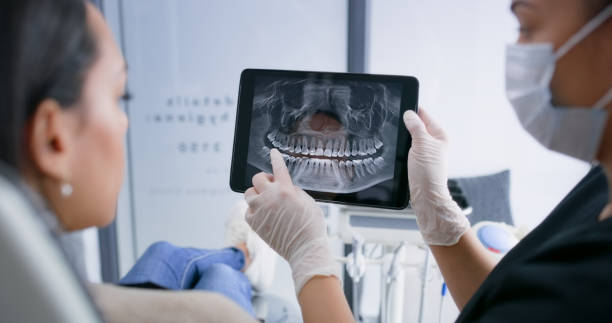 Licensed Wisdom Tooth Removal service in Washington, WA - Smile Center Dentistry